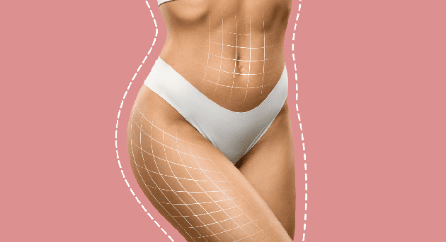 Cirugía de contorno corporal en Guadalajara, Jalisco: Todo lo que necesitas saber